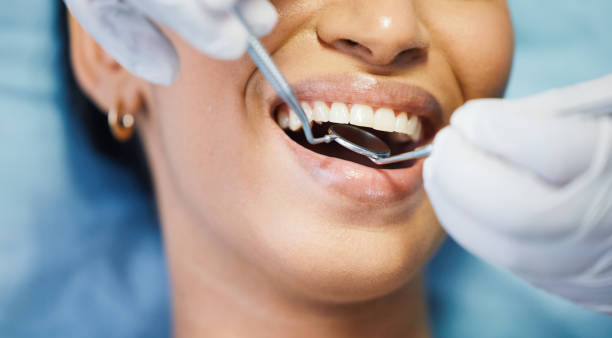 Best Emergency Tooth Extraction in San Rafael, CA