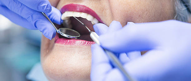 Best Cosmetic Emergency Dentistry in San Rafael, CA